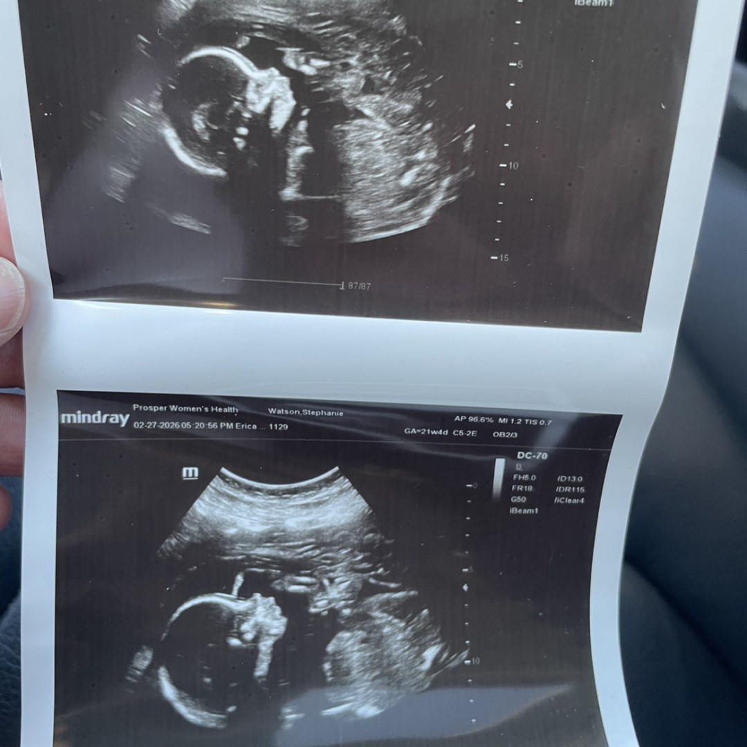 Photo shared by Stephanie for their Babylist baby registry.