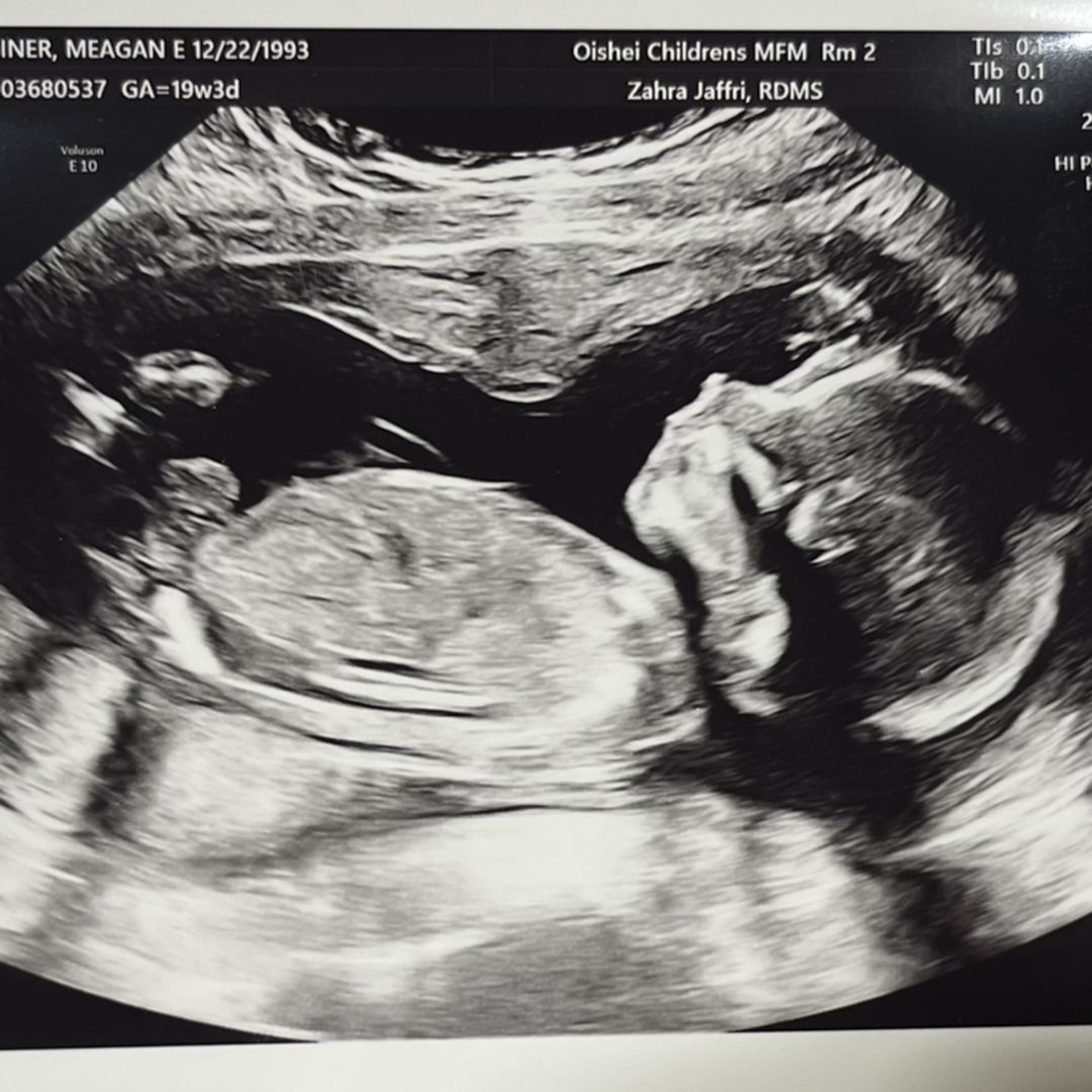 Photo shared by Meagan for their Babylist baby registry.