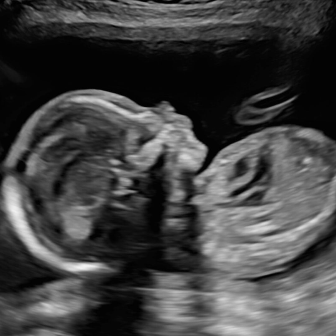 Photo shared by Maggie for their Babylist baby registry.