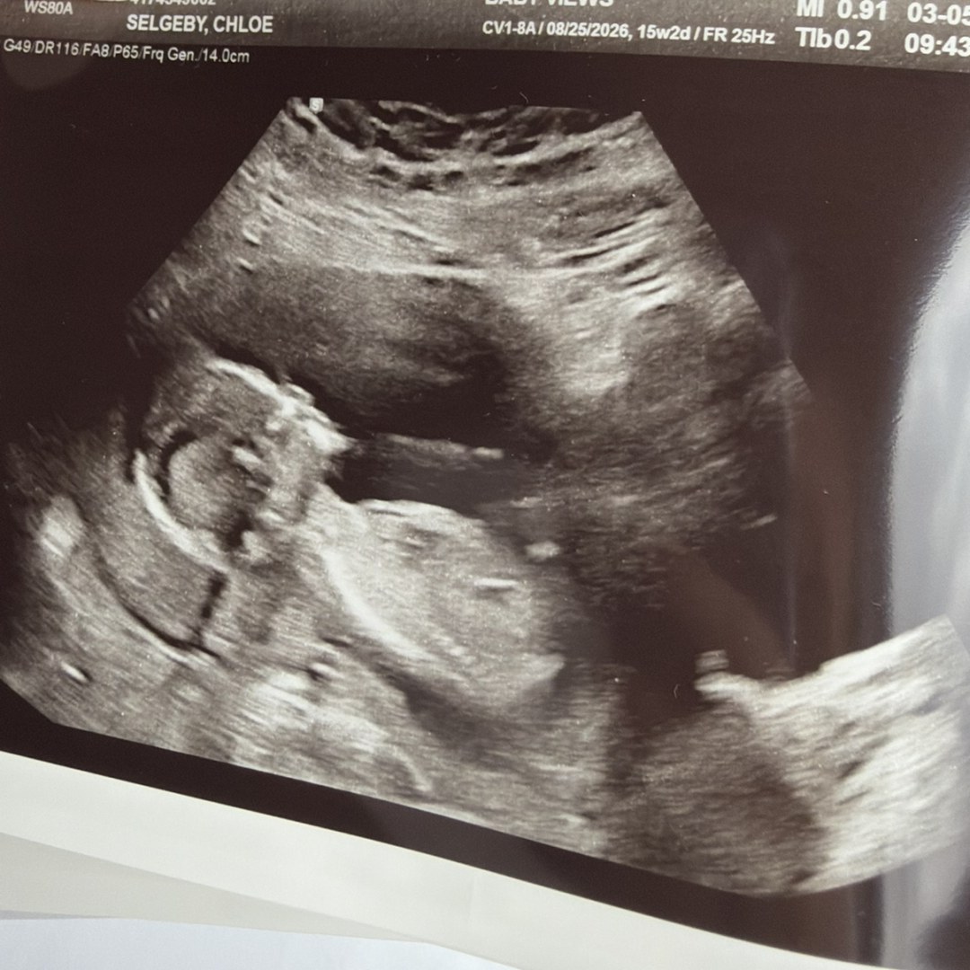 Photo shared by Chloe for their Babylist baby registry.