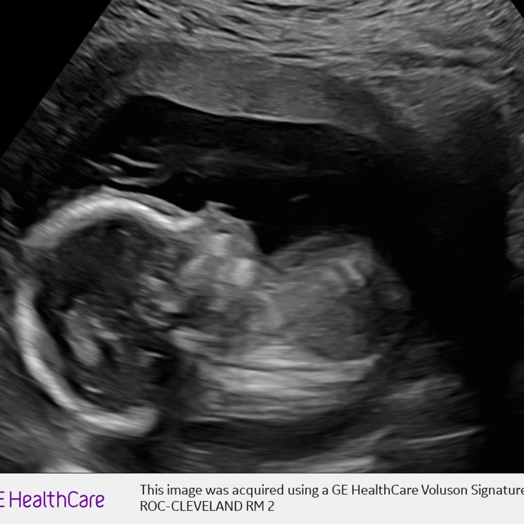 Photo shared by Alexis for their Babylist baby registry.