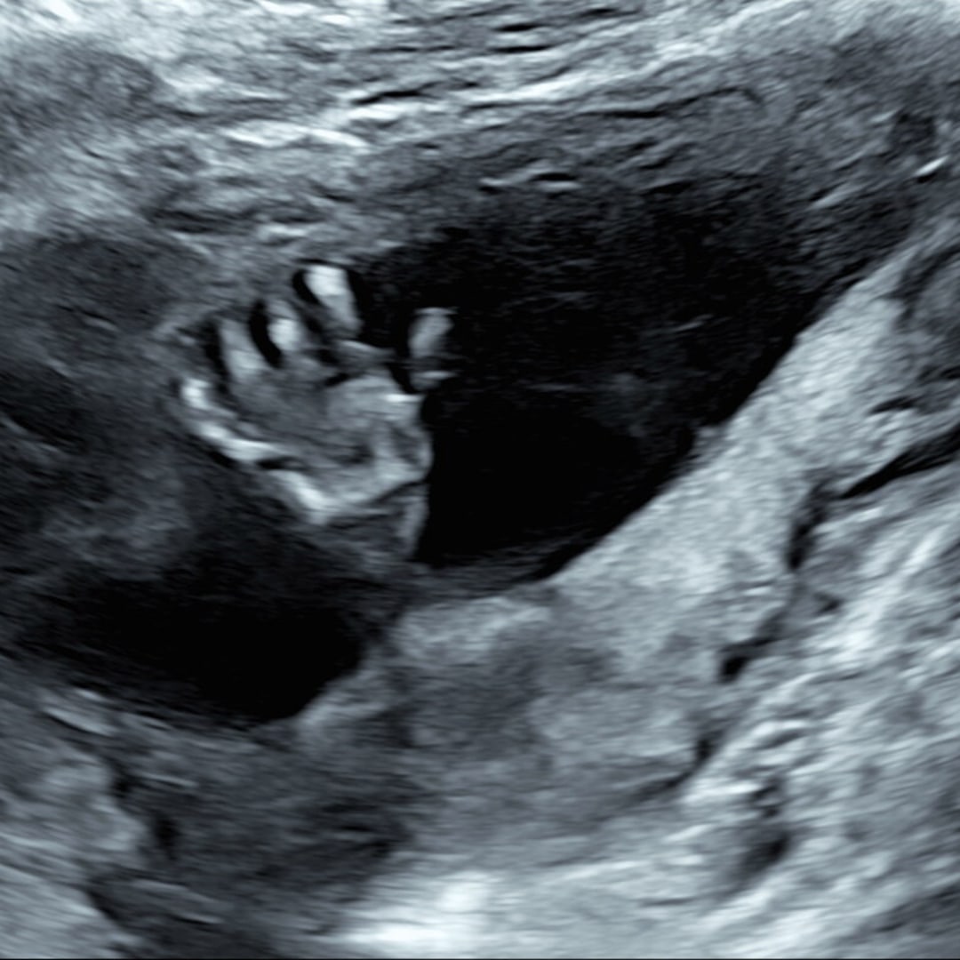 Photo shared by Leah for their Babylist baby registry.