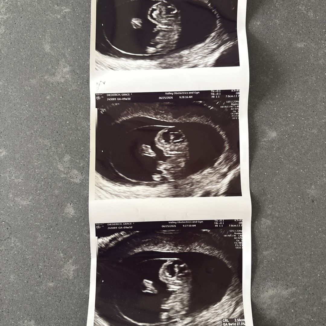 Photo shared by Grace for their Babylist baby registry.
