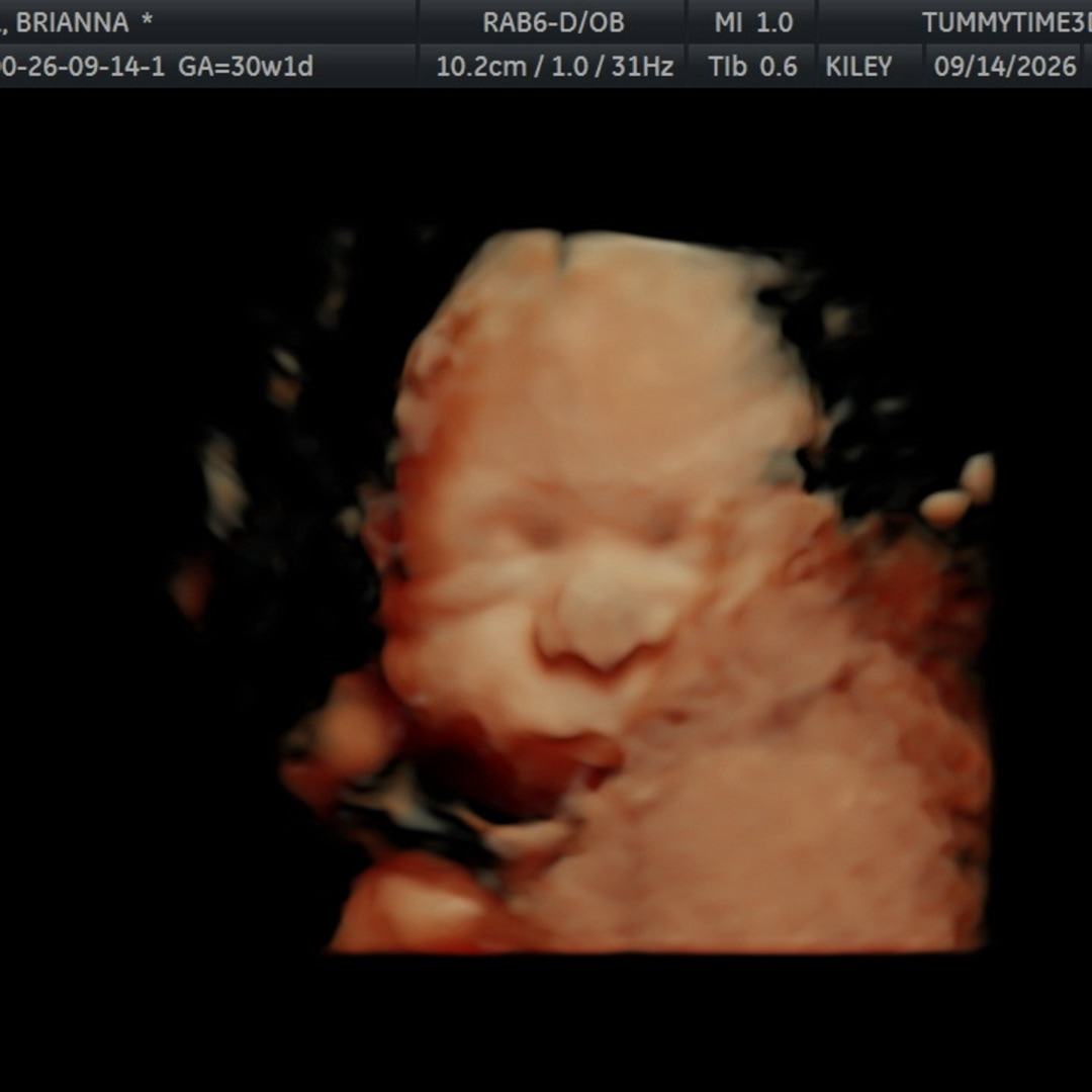 Photo shared by Brianna for their Babylist baby registry.