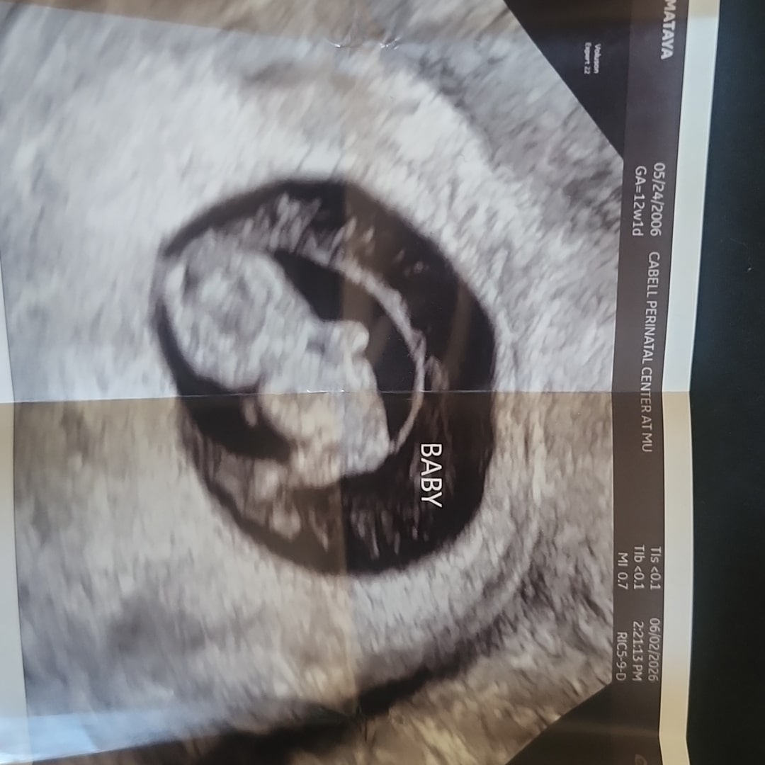 Photo shared by Aliyah for their Babylist baby registry.
