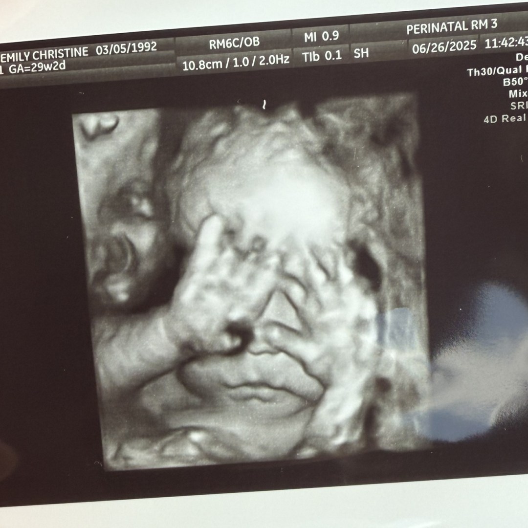 Photo shared by Emily for their Babylist baby registry.