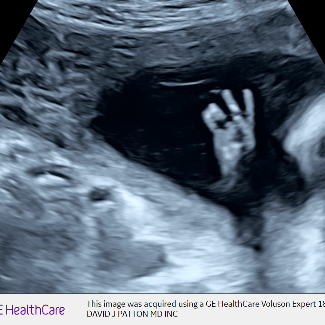 Photo shared by Christopher for their Babylist baby registry.