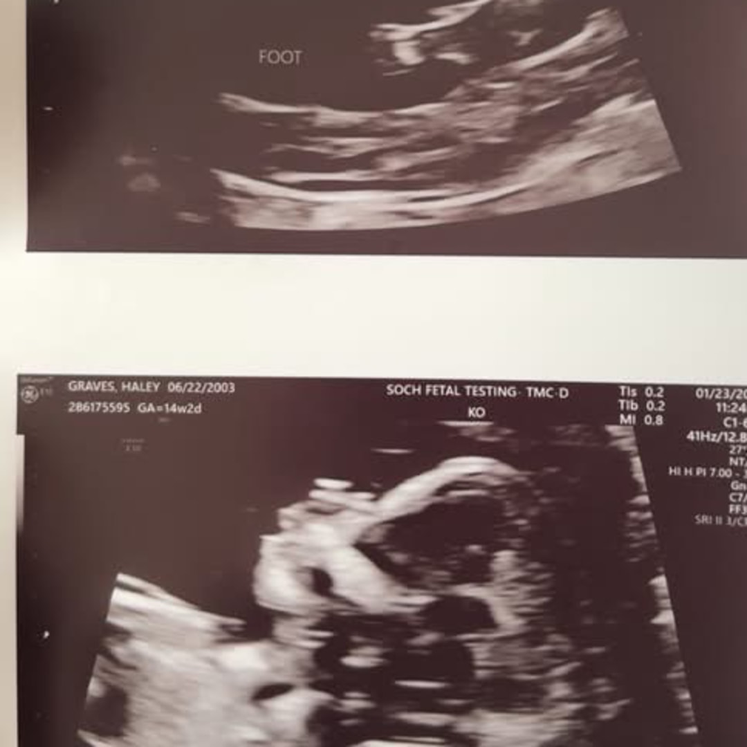 Photo shared by Haley for their Babylist baby registry.