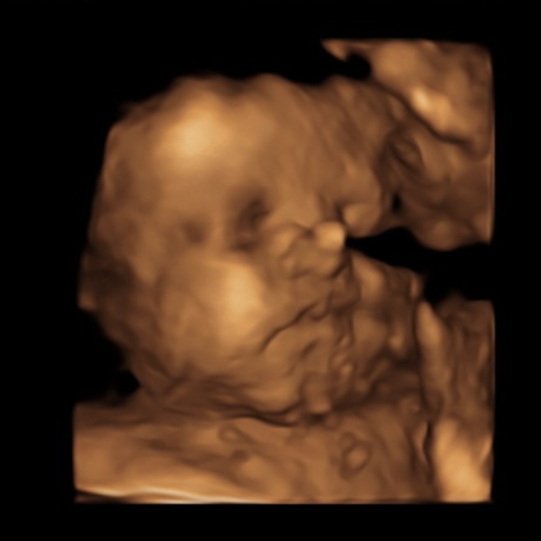 Photo shared by Kathlene for their Babylist baby registry.