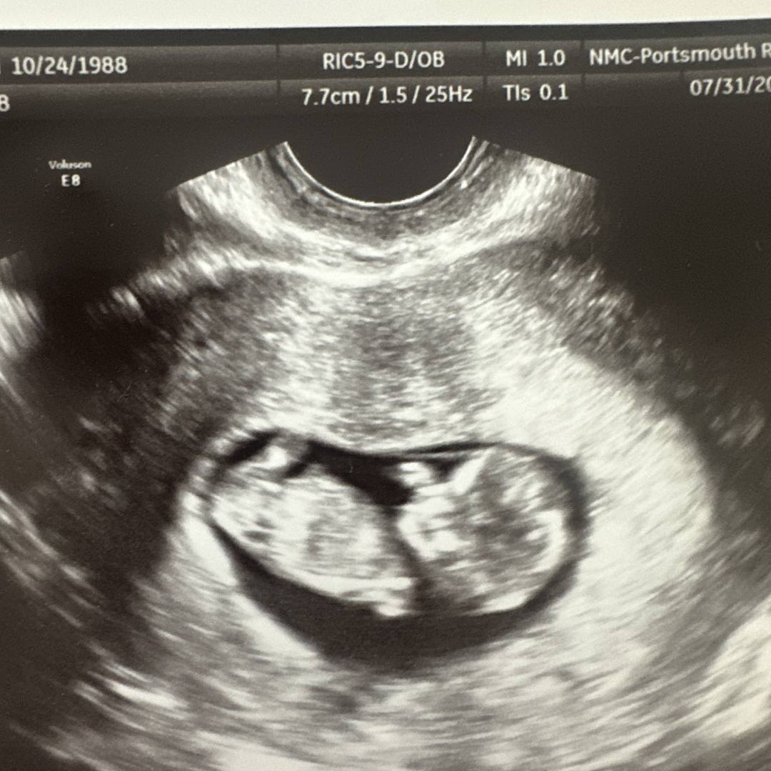 Photo shared by Laura for their Babylist baby registry.