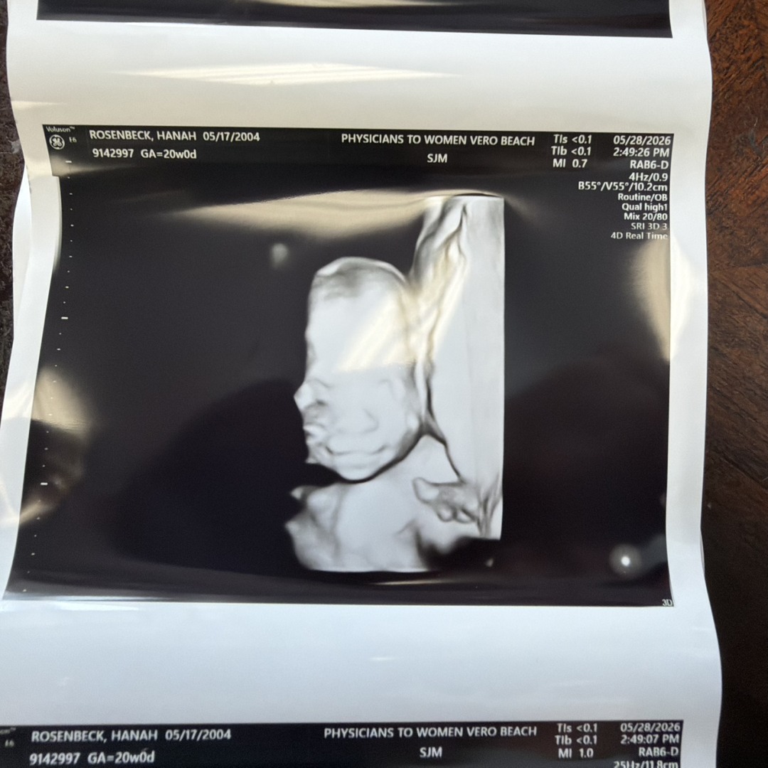 Photo shared by Hanah+Dante for their Babylist baby registry.