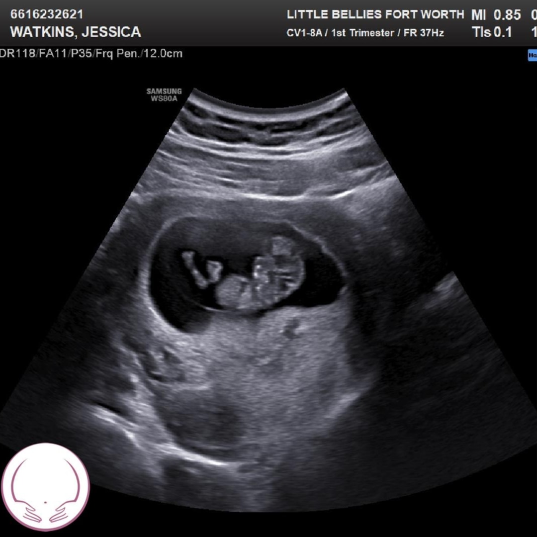 Photo shared by Jessica for their Babylist baby registry.