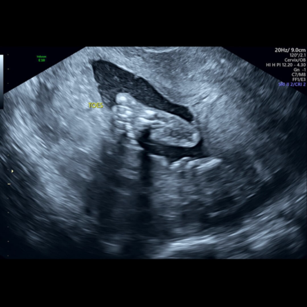 Photo shared by Abby for their Babylist baby registry.