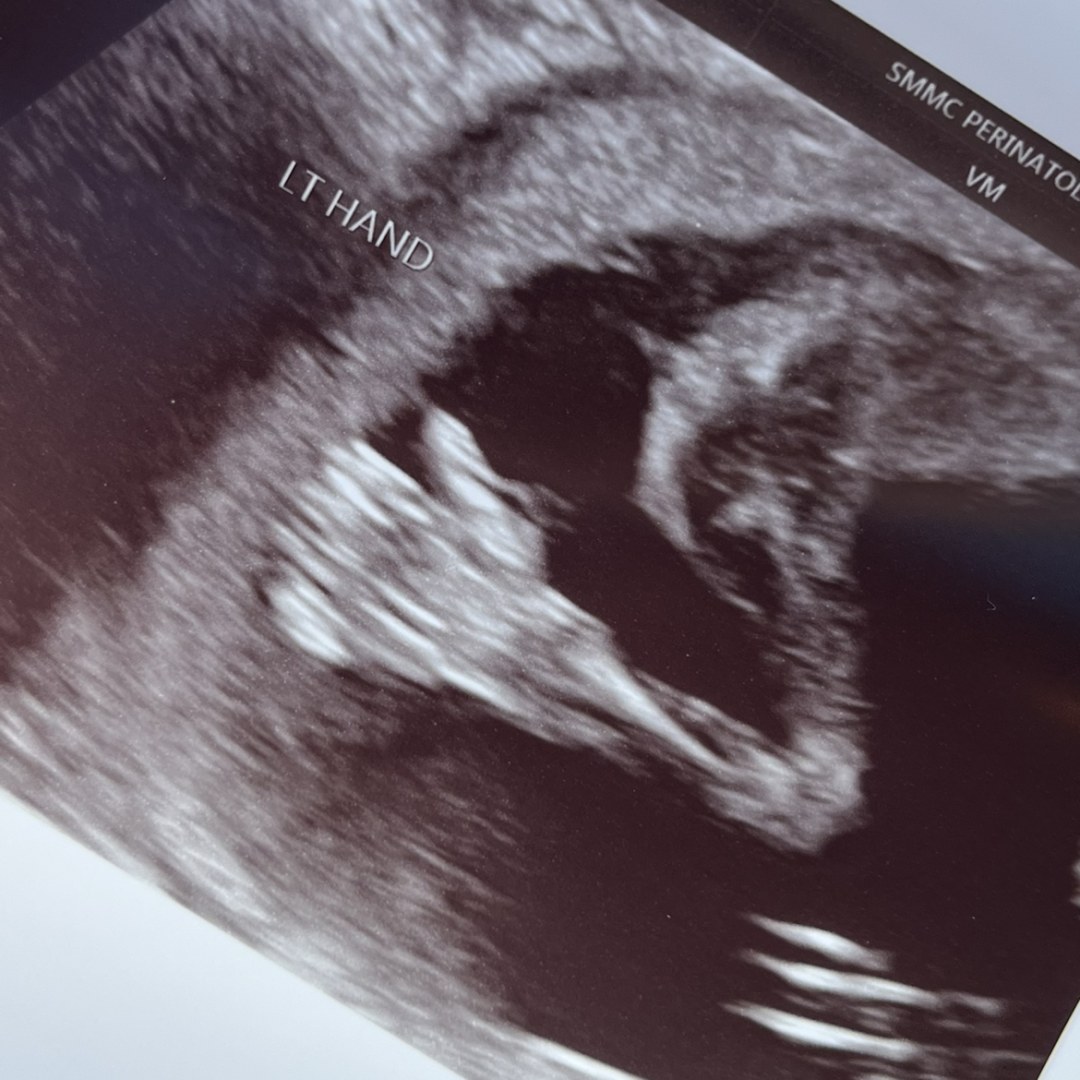 Photo shared by Carley for their Babylist baby registry.