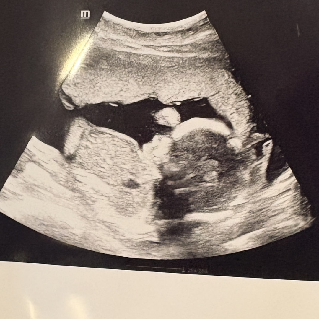 Photo shared by Shemaiah for their Babylist baby registry.