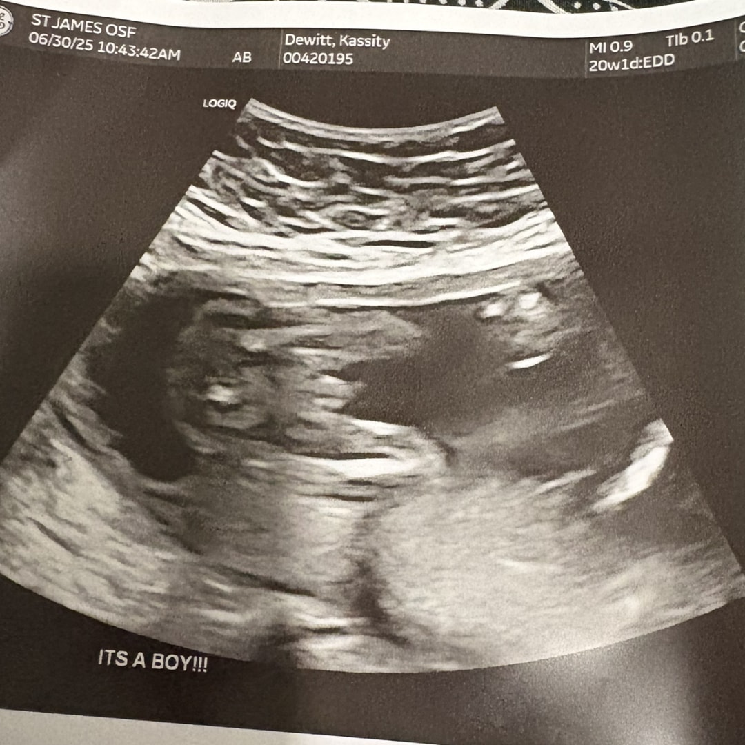 Photo shared by Kassity for their Babylist baby registry.