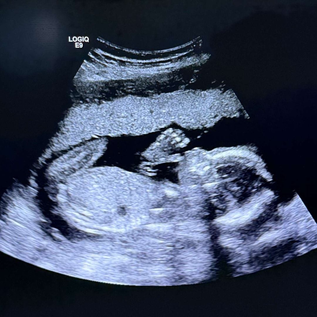Photo shared by Destiny for their Babylist baby registry.