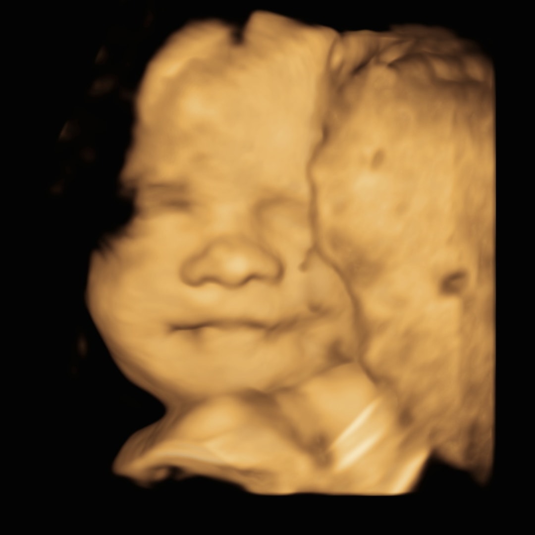 Photo shared by Emely for their Babylist baby registry.