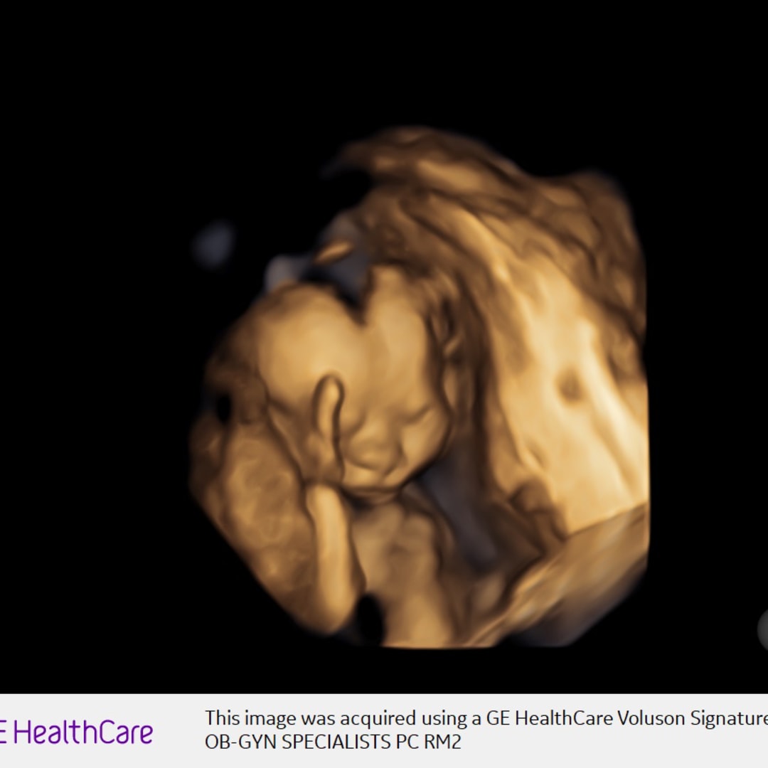 Photo shared by Nikki for their Babylist baby registry.