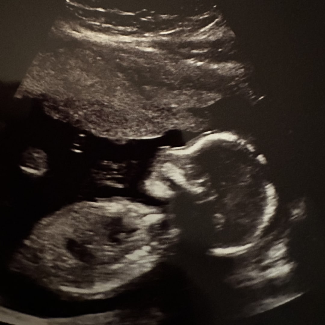 Photo shared by Andrea for their Babylist baby registry.