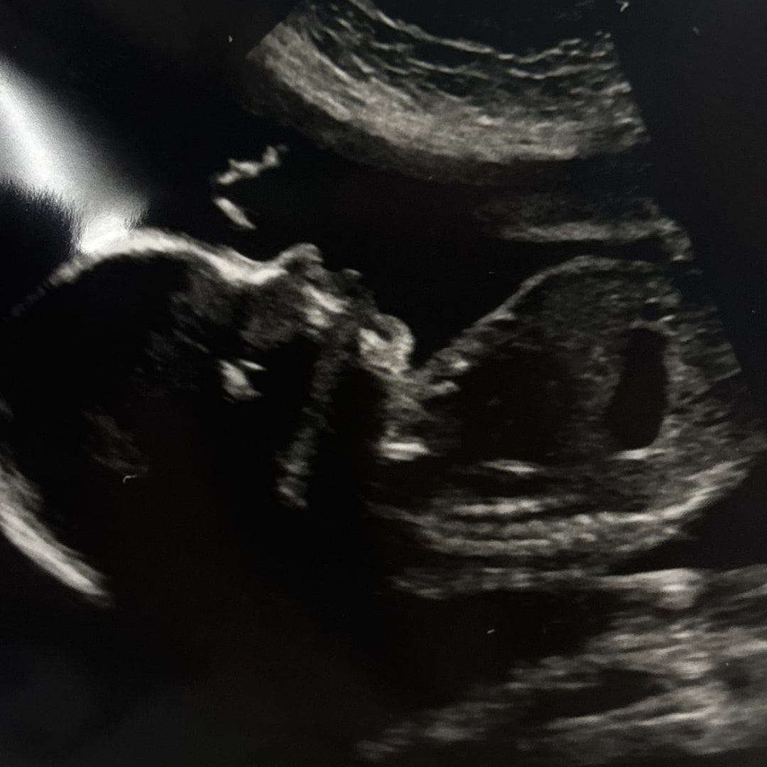 Photo shared by Amber for their Babylist baby registry.