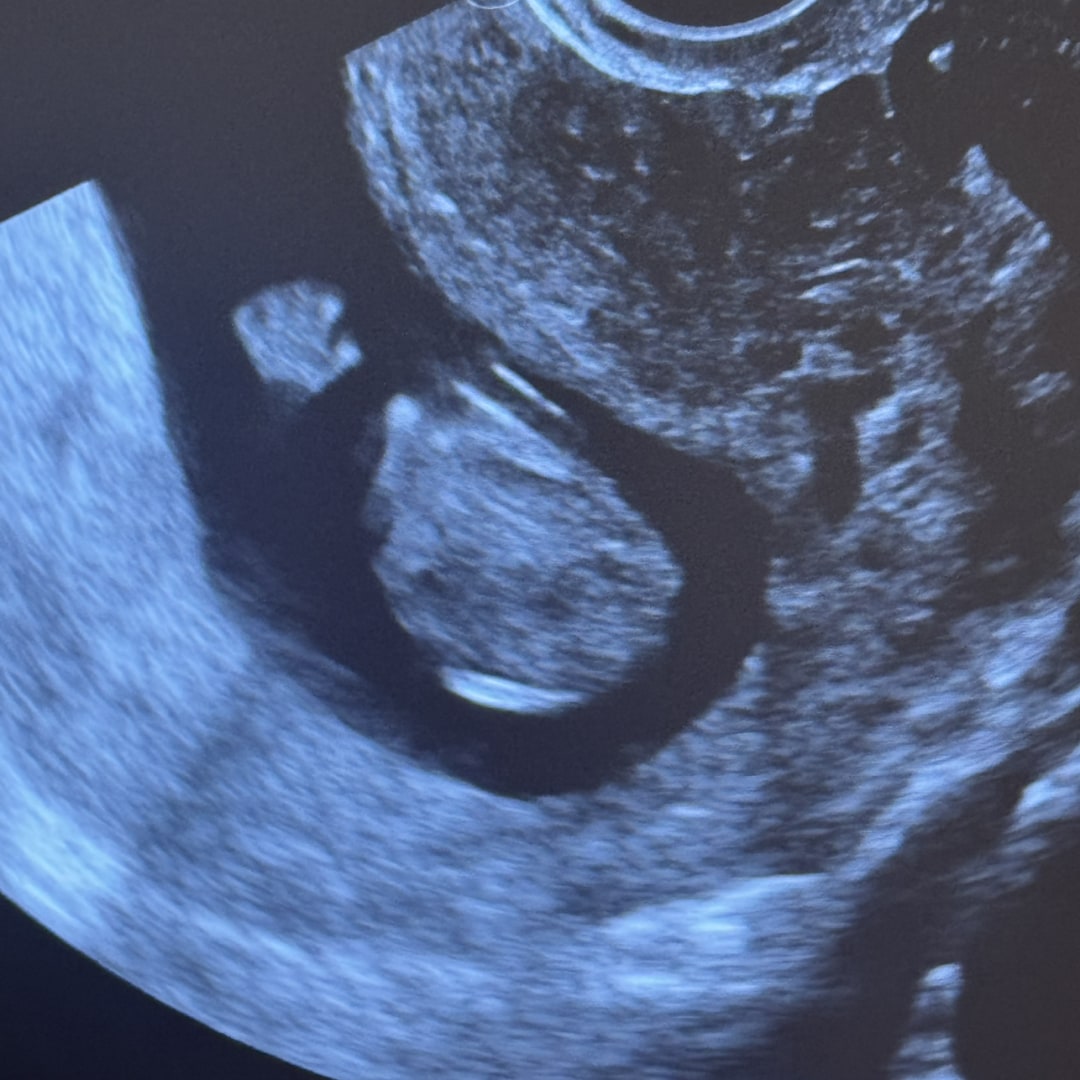 Photo shared by Elexies for their Babylist baby registry.