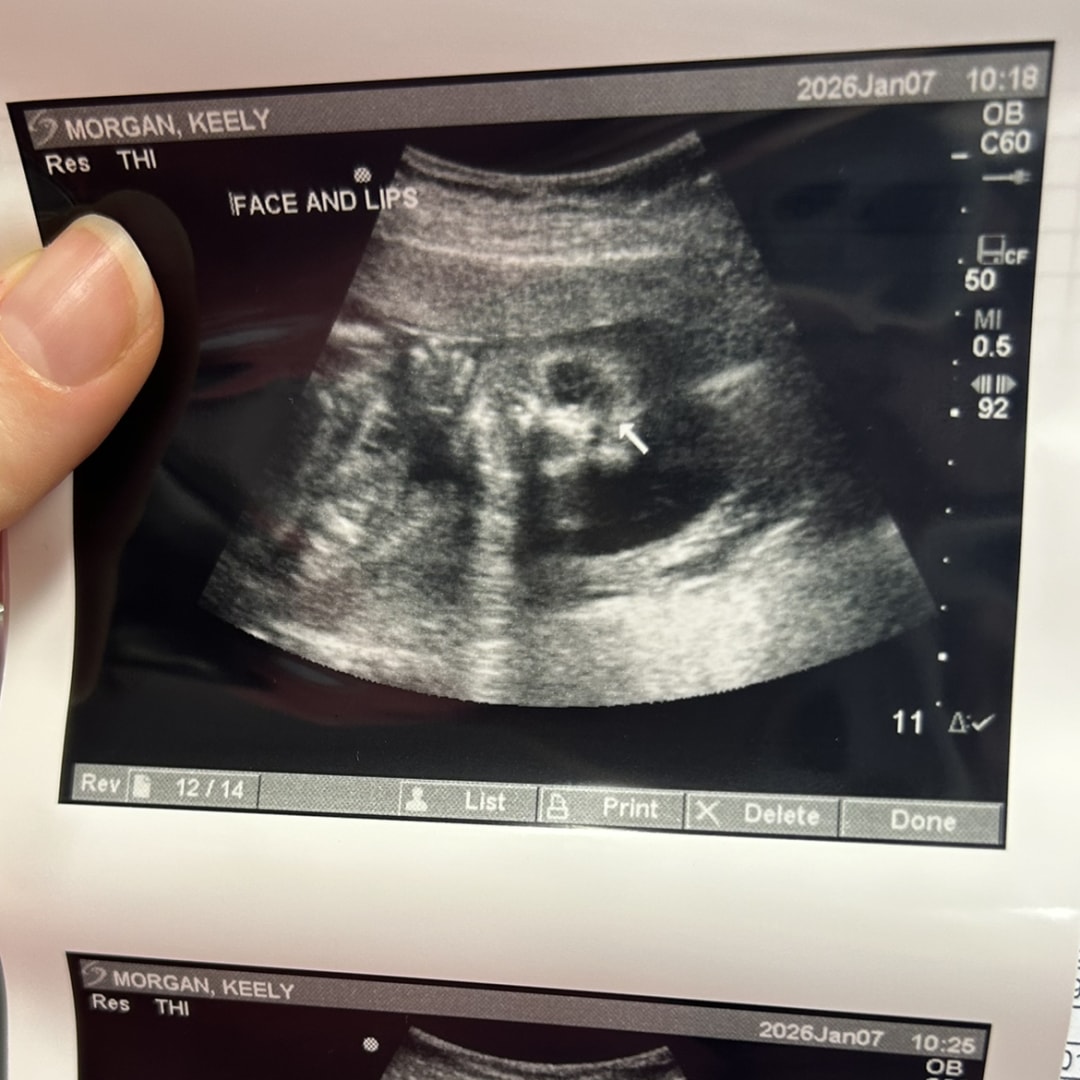 Photo shared by Keely for their Babylist baby registry.