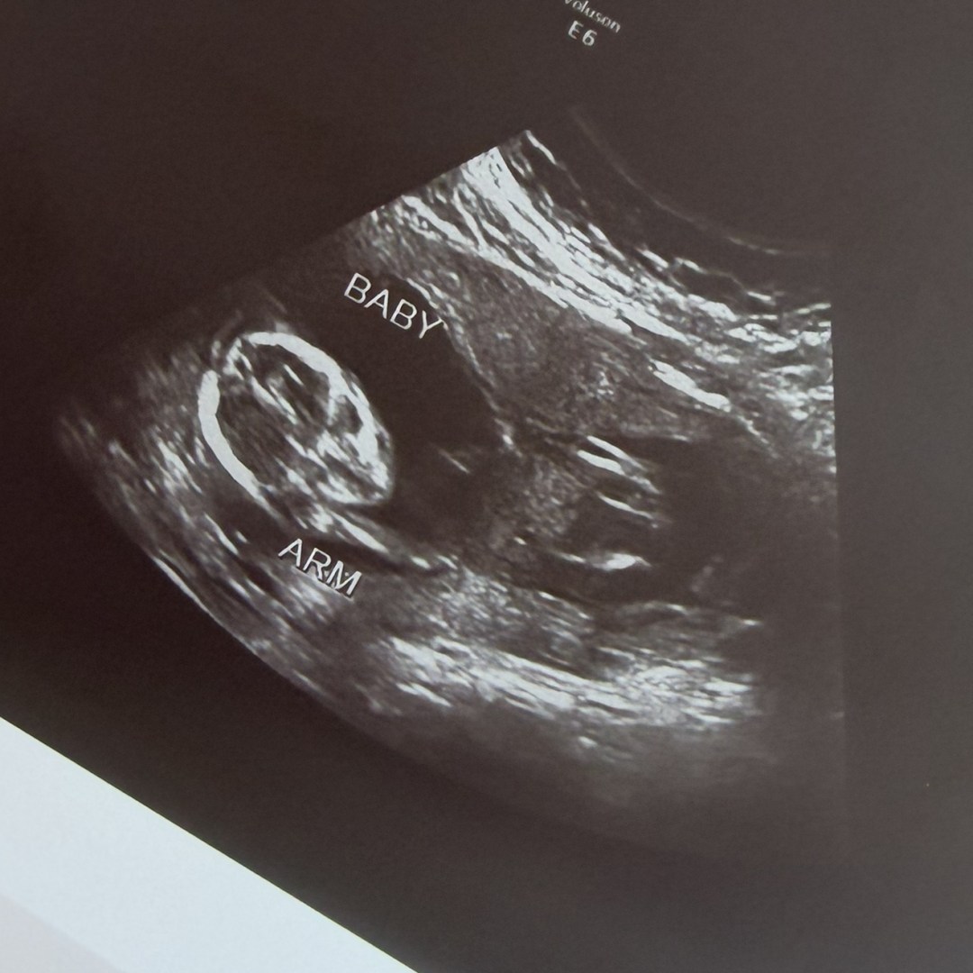 Photo shared by Jennie for their Babylist baby registry.