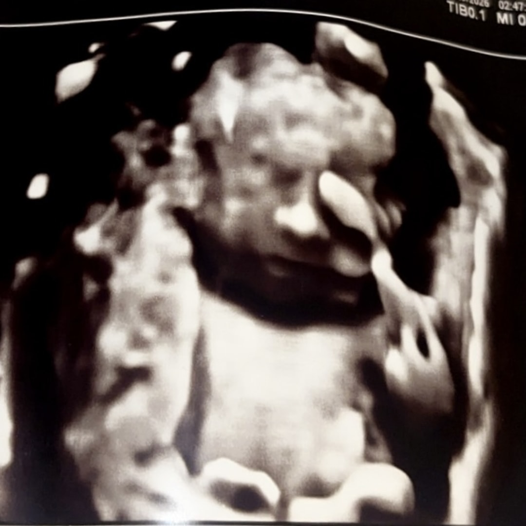 Photo shared by Gaby for their Babylist baby registry.