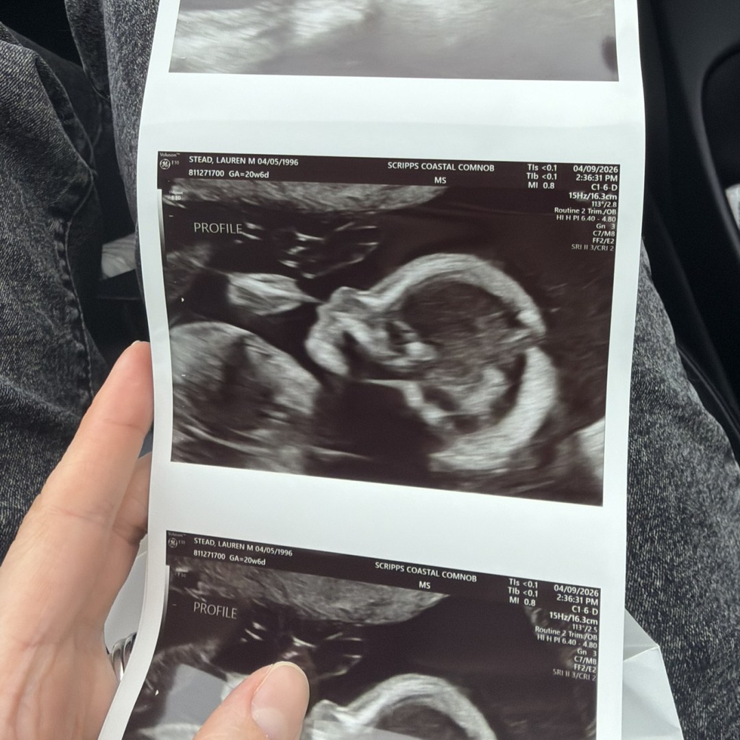Photo shared by Lauren for their Babylist baby registry.