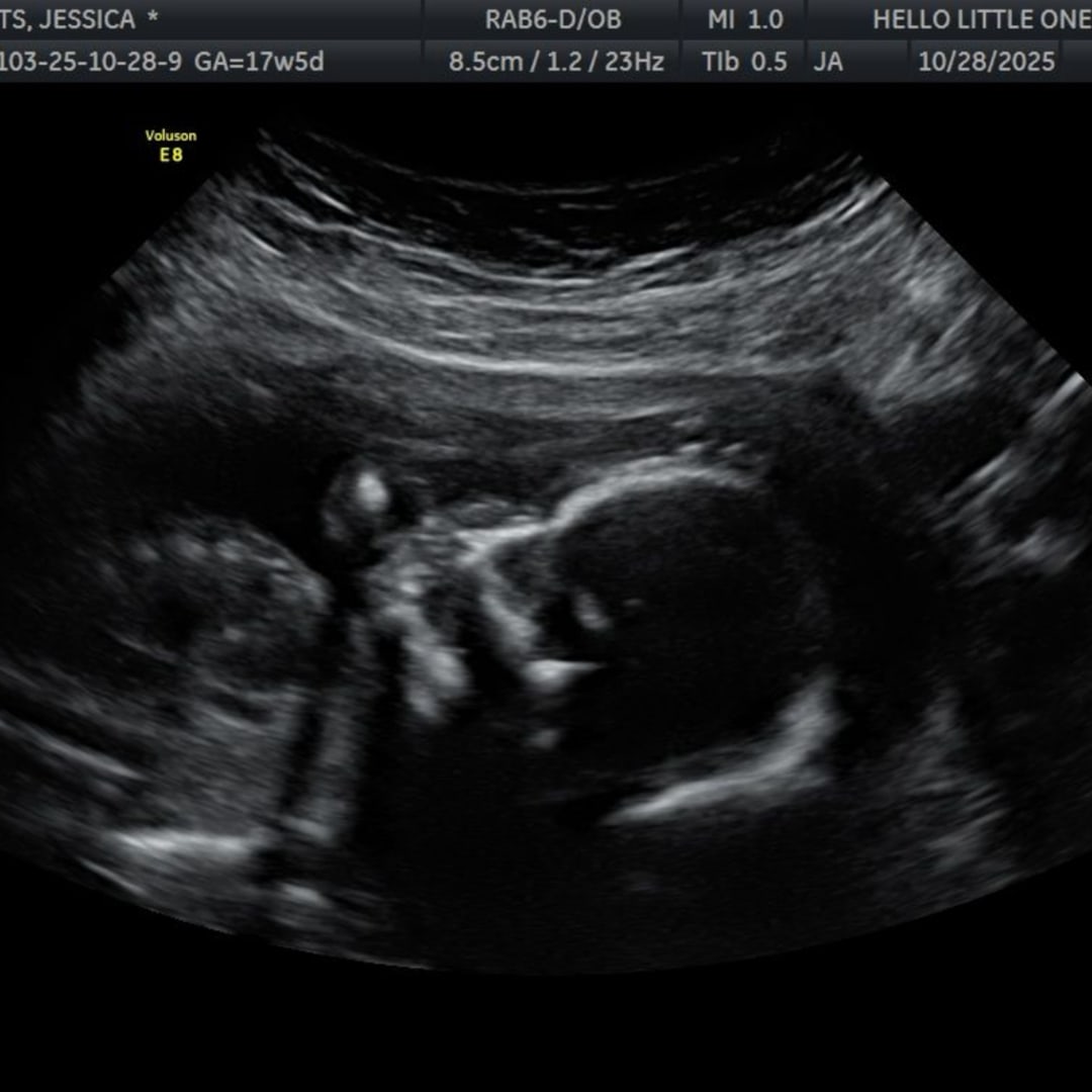 Photo shared by Jessica for their Babylist baby registry.