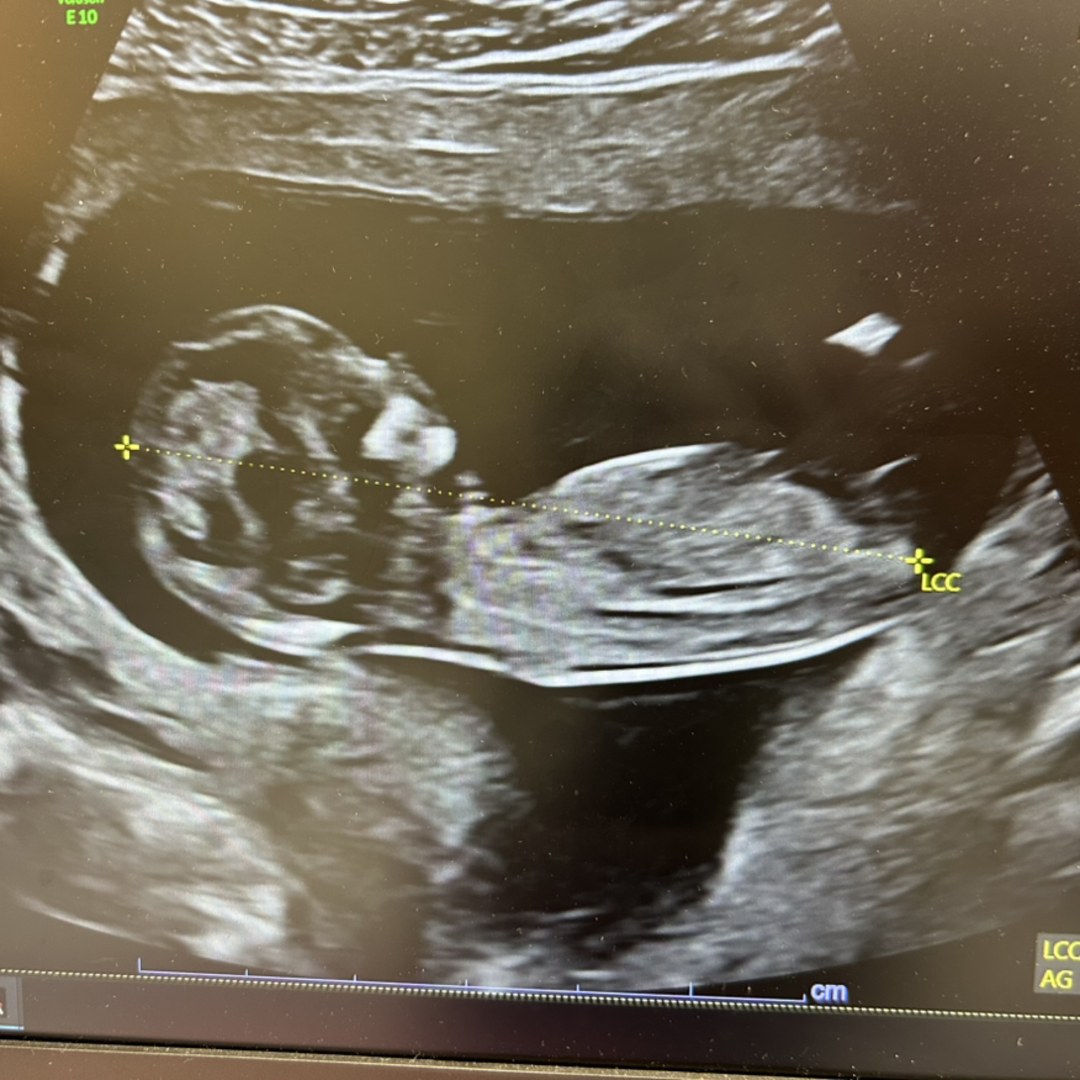 Photo shared by Valérie for their Babylist baby registry.