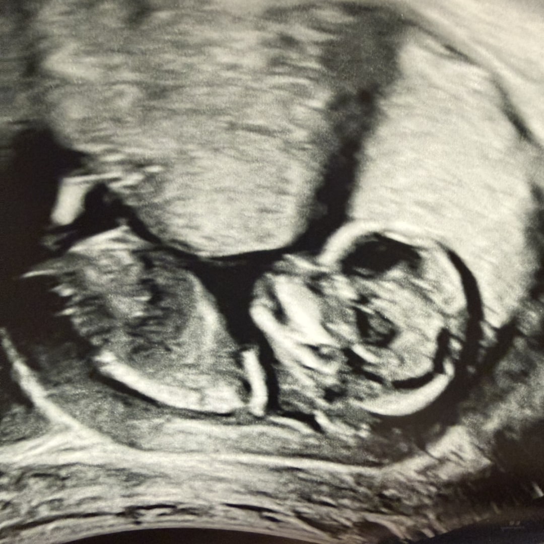 Photo shared by Hannah for their Babylist baby registry.