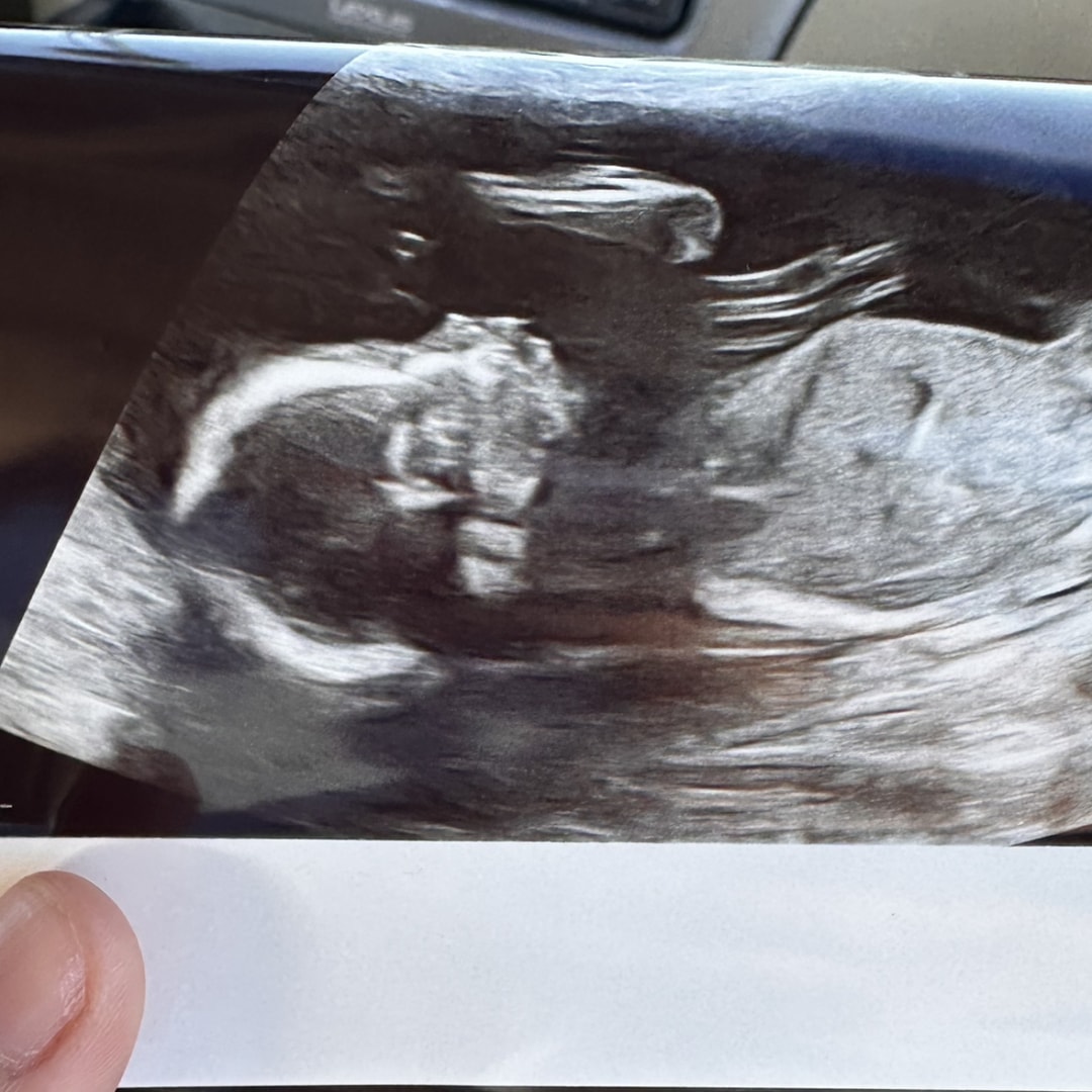 Photo shared by Ivonne for their Babylist baby registry.