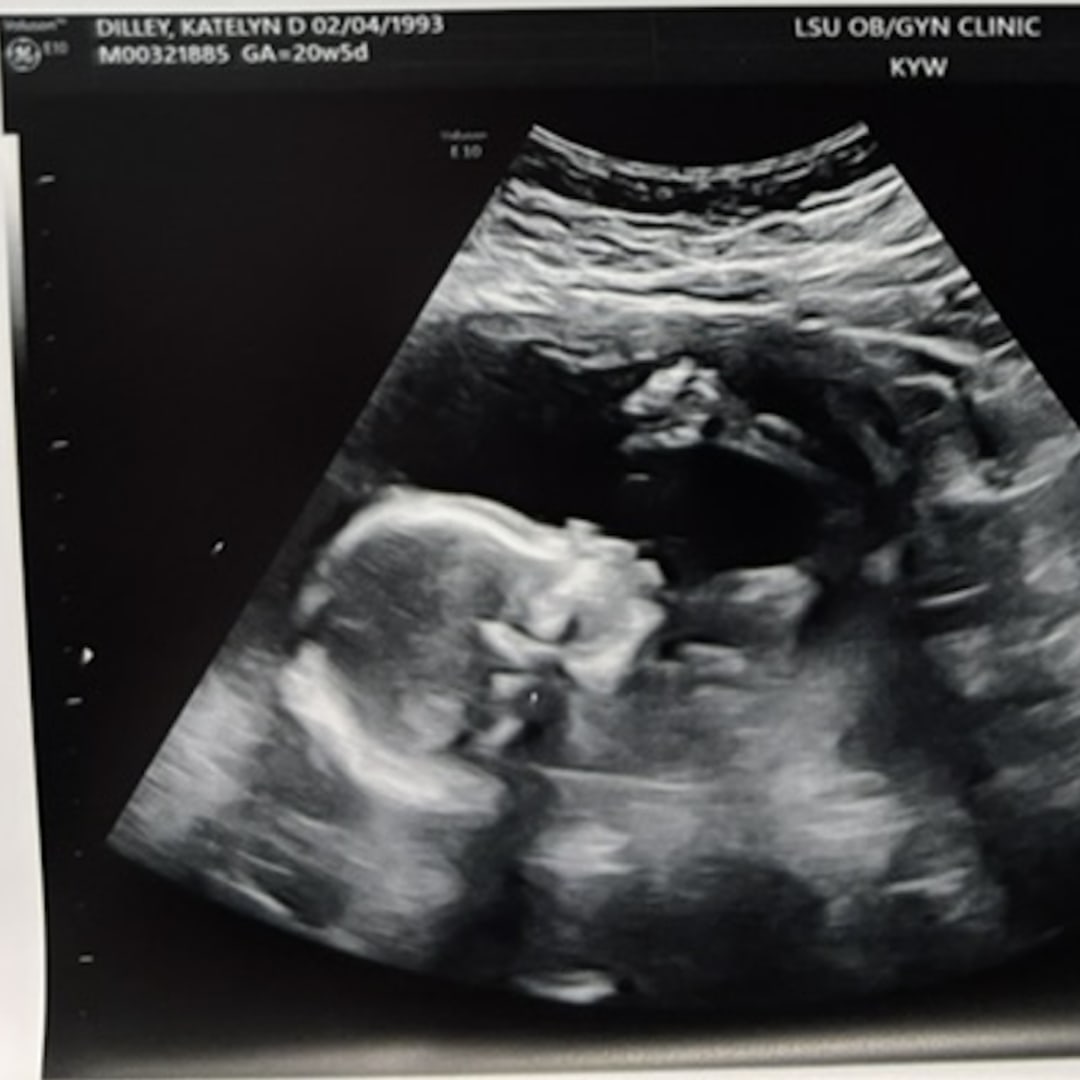 Photo shared by Katie for their Babylist baby registry.