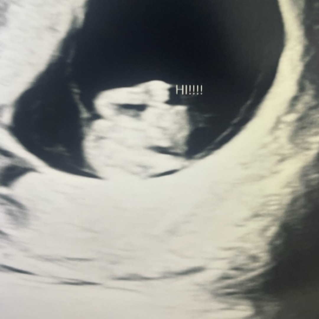 Photo shared by Gianna for their Babylist baby registry.
