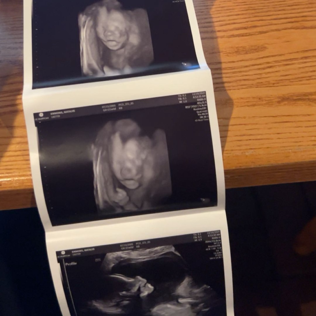 Photo shared by Natalye for their Babylist baby registry.