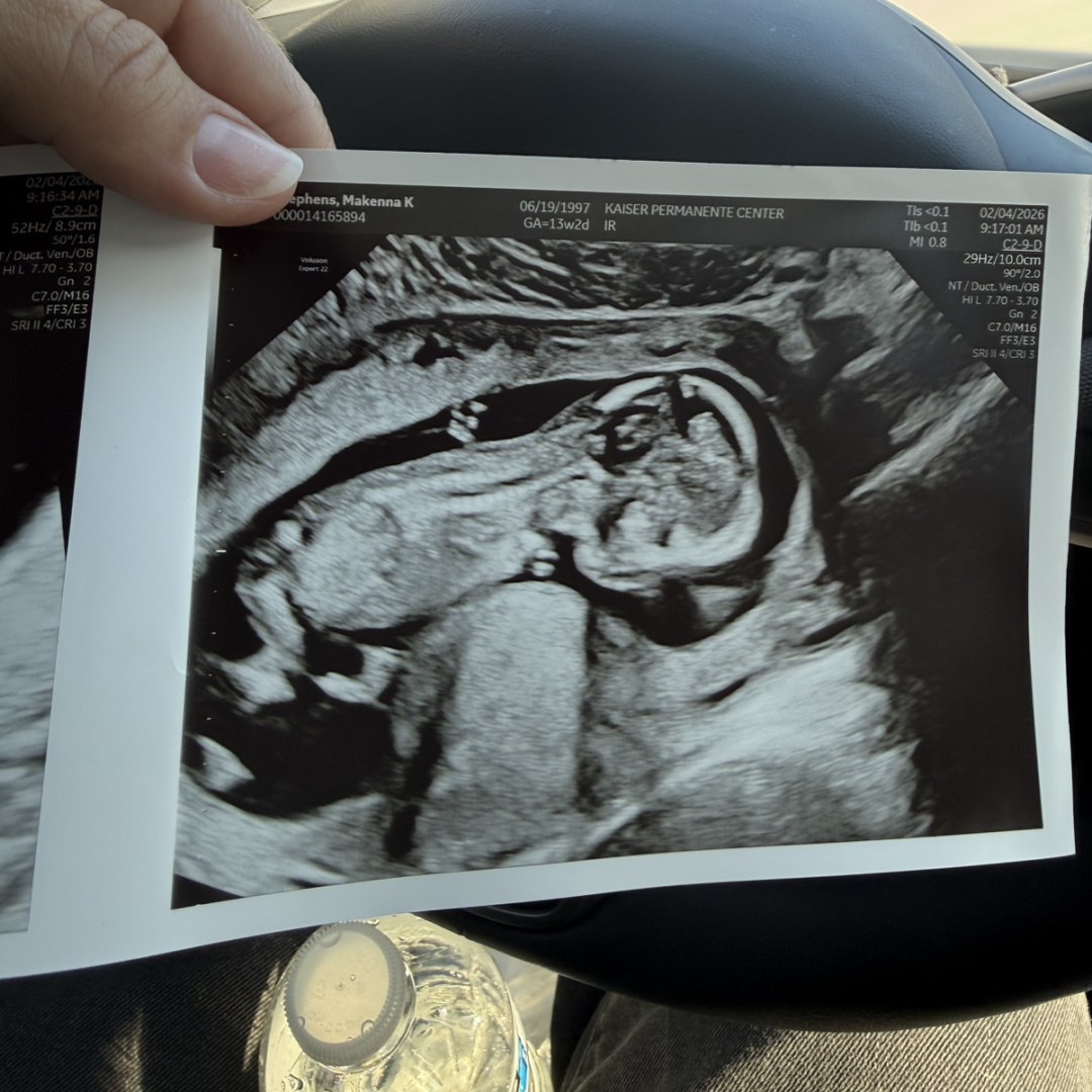 Photo shared by Makenna for their Babylist baby registry.