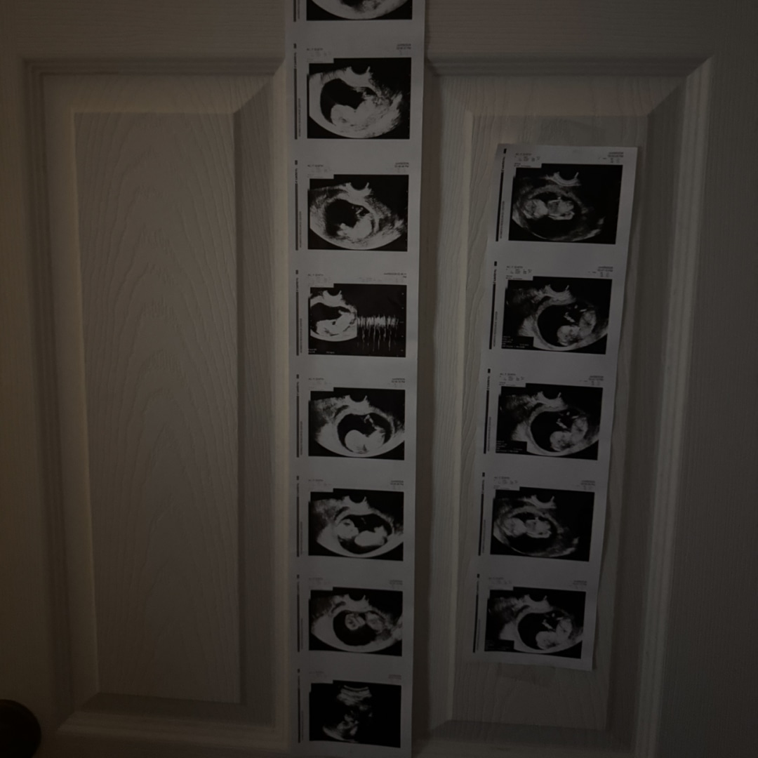 Photo shared by Ava for their Babylist baby registry.