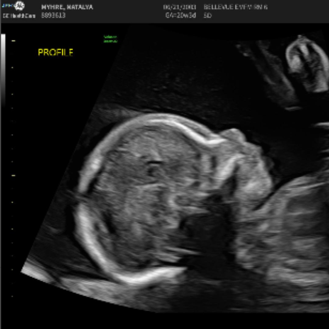 Photo shared by Natalya for their Babylist baby registry.