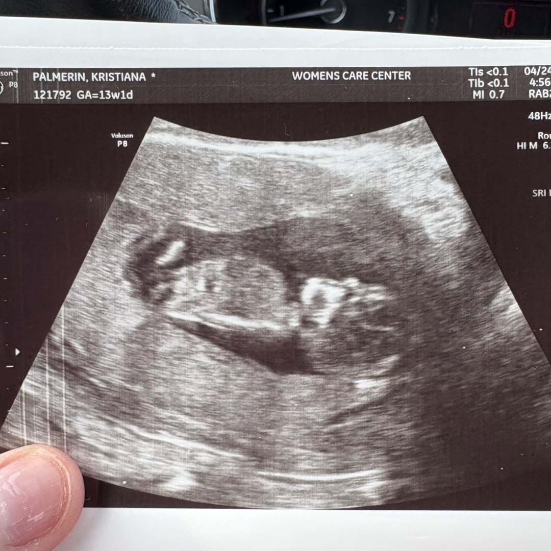 Photo shared by Kristiana for their Babylist baby registry.