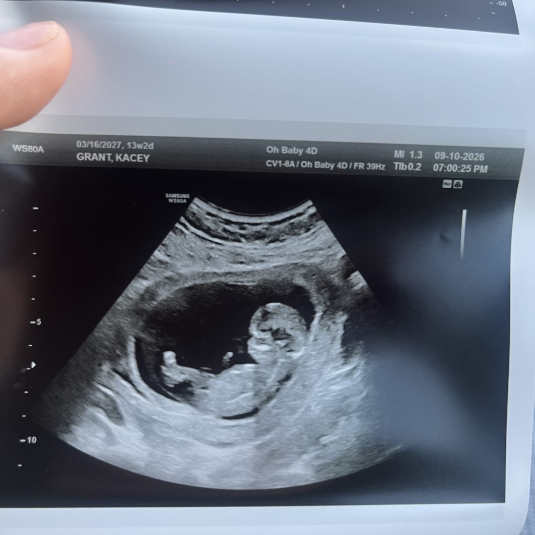 Photo shared by KC for their Babylist baby registry.