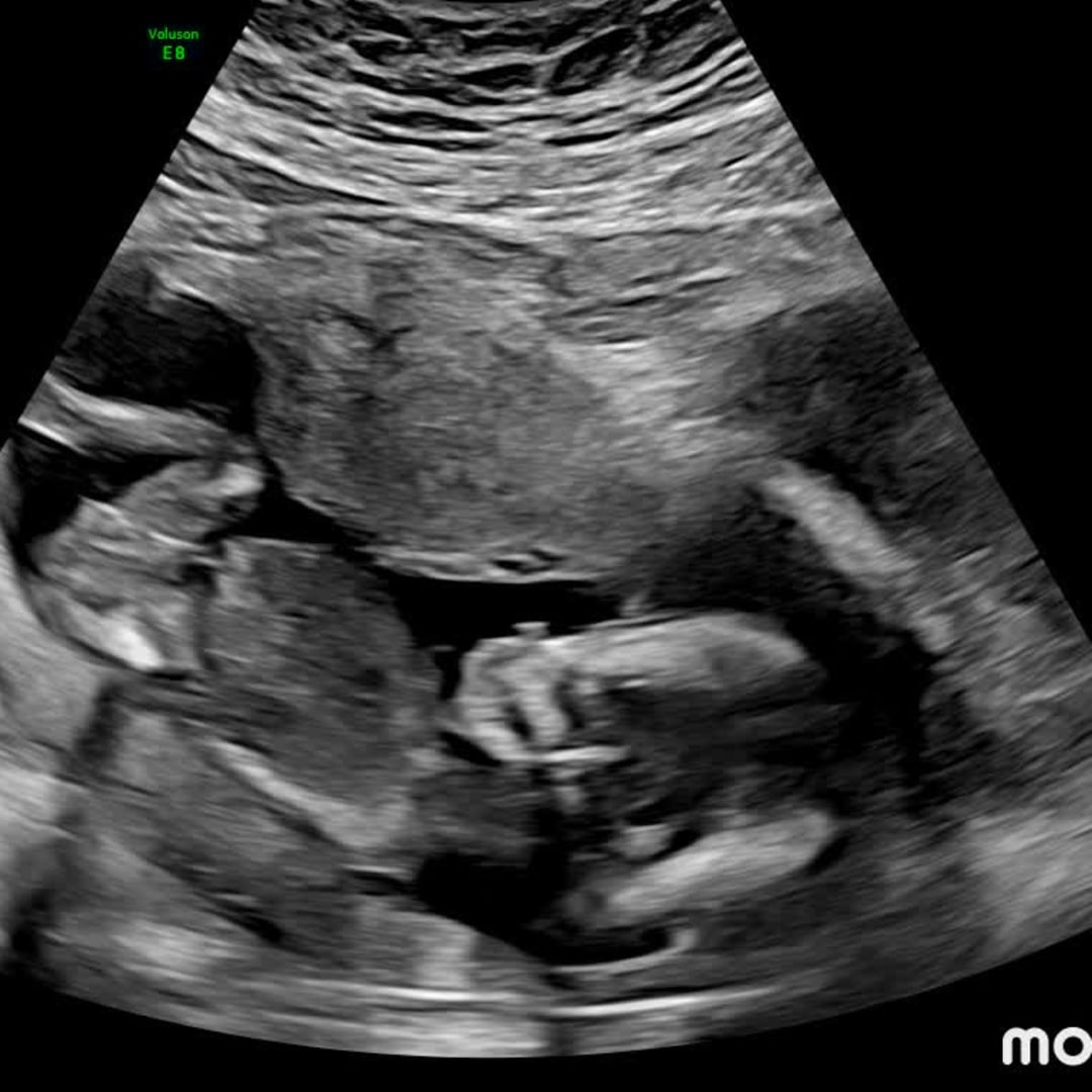 Photo shared by Kaleigh for their Babylist baby registry.