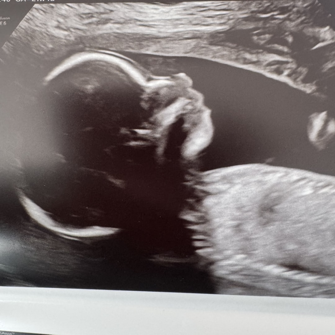 Photo shared by EveLynn for their Babylist baby registry.