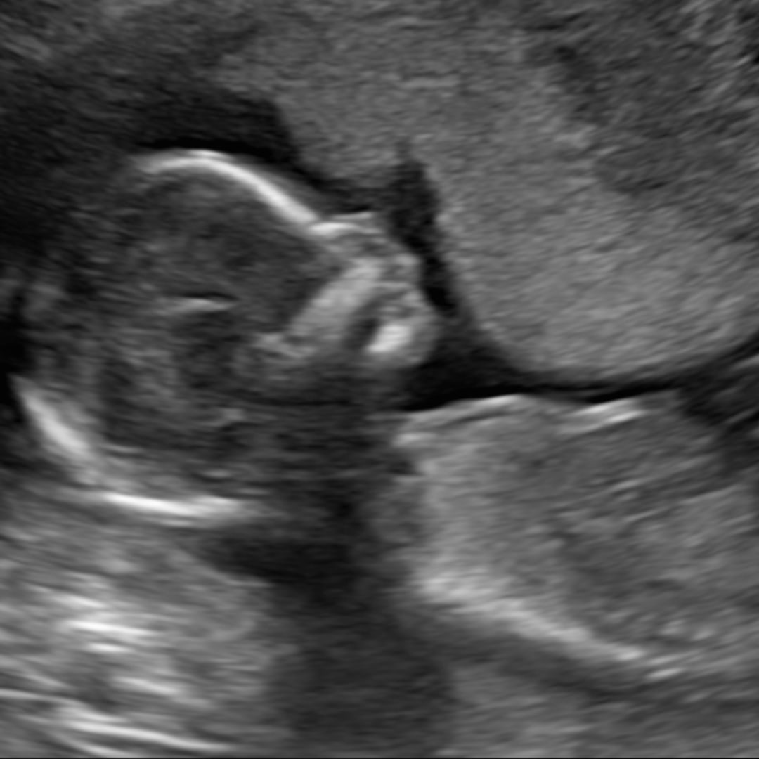 Photo shared by Faith for their Babylist baby registry.