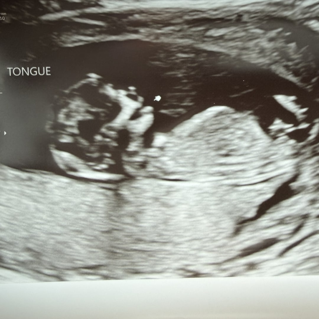 Photo shared by Brieanna for their Babylist baby registry.