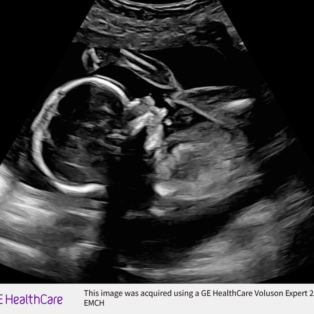 Photo shared by Elizabeth for their Babylist baby registry.