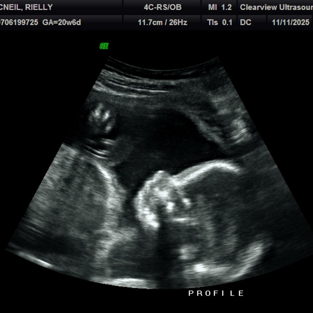 Photo shared by Rielly for their Babylist baby registry.