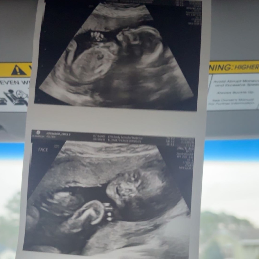 Photo shared by Emily for their Babylist baby registry.