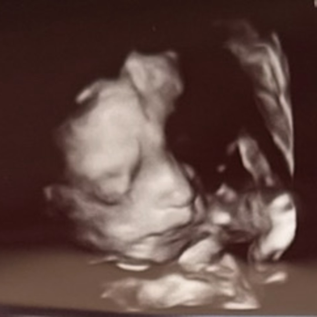 Photo shared by Alice for their Babylist baby registry.